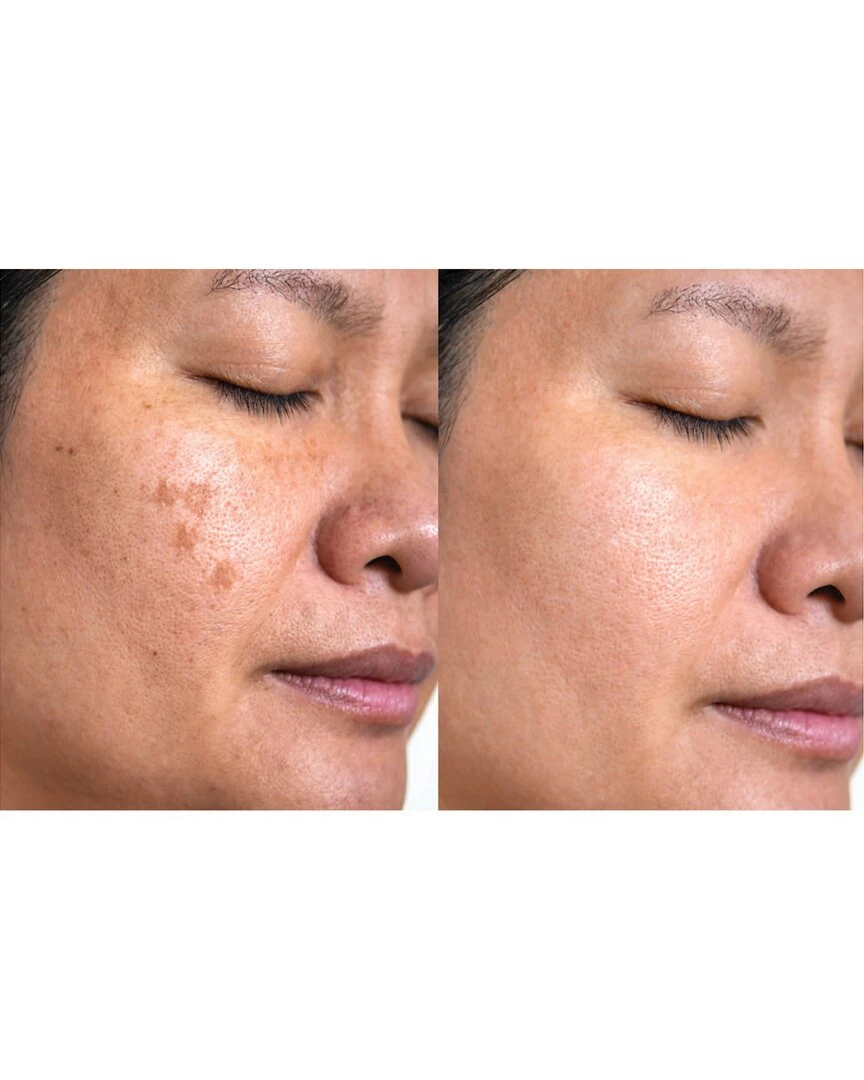 Predire Paris Collagen & Stem Cell Skin Transformation Routine Women Skincare Sets Predire Paris Collagen & Stem Cell Skin Transformation Routine Women Skincare Sets -Predire Paris Store 1111151313 RLLZ 2