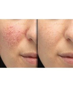 Predire Paris Anti-Aging Multi-Treatment Serum Collection Women Skincare Sets -Predire Paris Store 1111182716 RLLZ 9