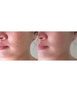 Predire Paris LED 11X Infrared Anti Aging Device Women Tools & Styling -Predire Paris Store 1111632244 RLLZ 6