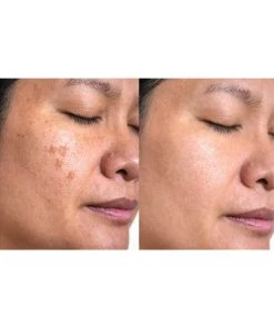 Predire Paris Collagen & Stem Cell Skin Transformation Routine Women Skincare Sets -Predire Paris Store 1111725373 RLLZ 2