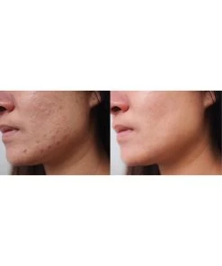 Predire Paris 12x PRO LED Device With Spa Steam Hot/Cold Technologies Women Tools & Styling -Predire Paris Store 1111952281 RLLZ 3