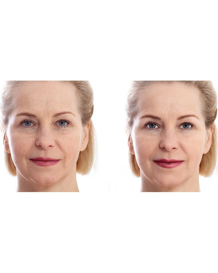 Predire Paris 16pc Anti-Aging Oxygen & Stem Cell Mask Set Women Skincare Sets Predire Paris 16pc Anti-Aging Oxygen & Stem Cell Mask Set Women Skincare Sets -Predire Paris Store 4120163665 RLLZ 3