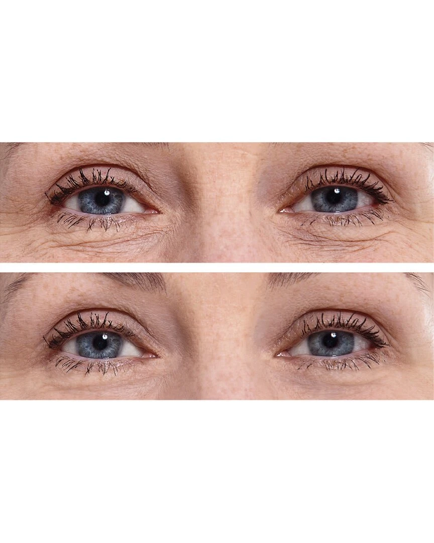 Predire Paris Complete Intensive Rapid Renewal Eye Care Anti Aging Collection Women Skincare Sets Predire Paris Complete Intensive Rapid Renewal Eye Care Anti Aging Collection Women Skincare Sets -Predire Paris Store 4120566516 RLLZ 2