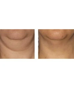 Predire Paris 1.35oz Red Wine Intensive Serum Face, Neck And Chest Women Skincare Treatments -Predire Paris Store 4120756944 RLLZ 2